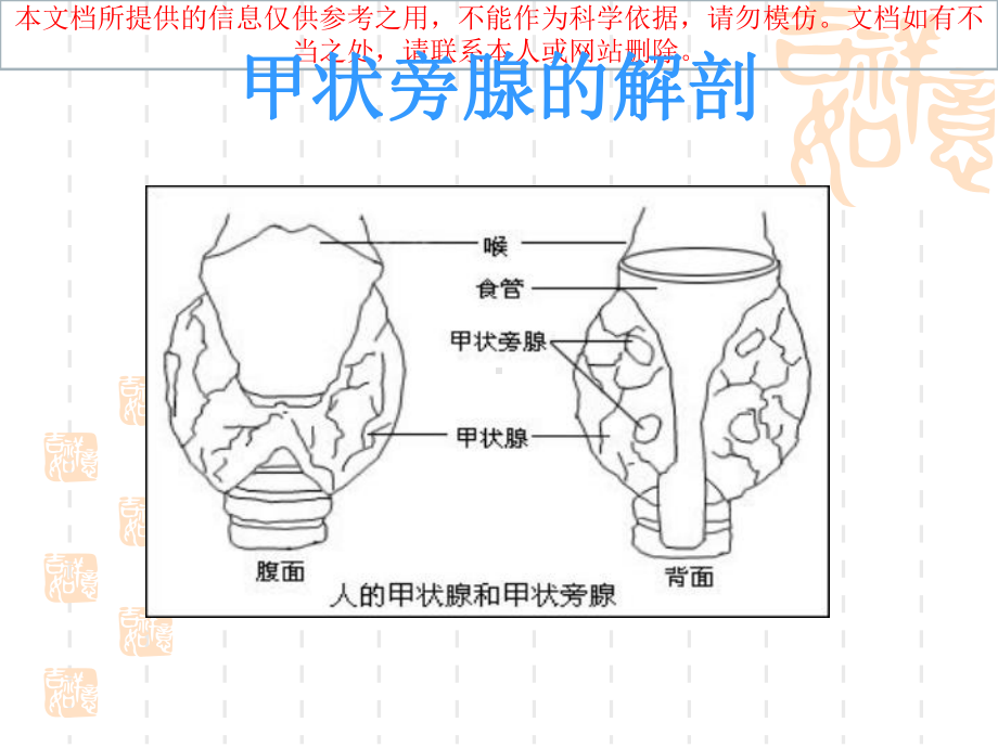 甲状旁腺功能减退精美讲解培训课件.ppt_第1页