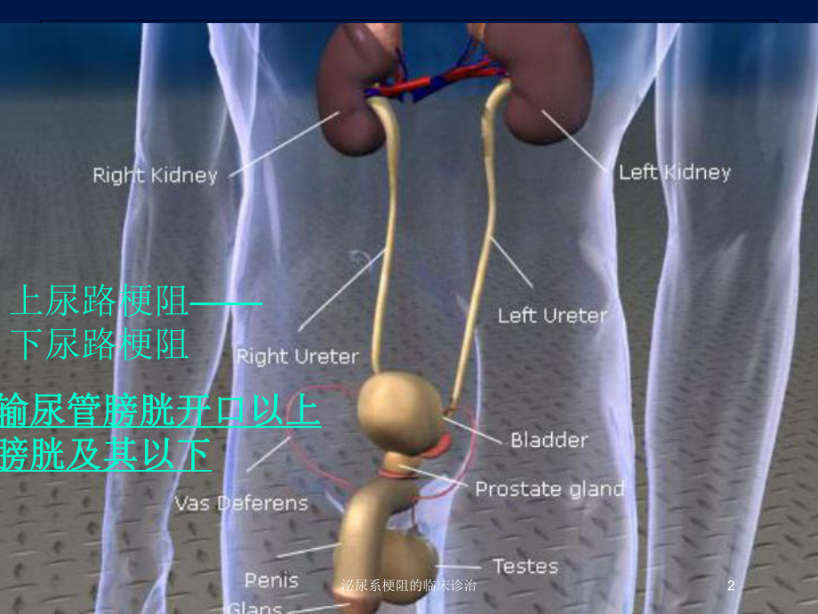 泌尿系梗阻的临床诊治培训课件.ppt_第2页