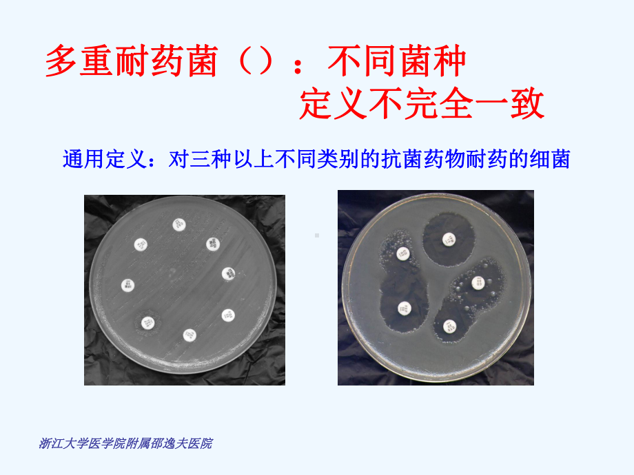 泛耐药鲍曼不动感染流行及治疗课件.ppt_第2页