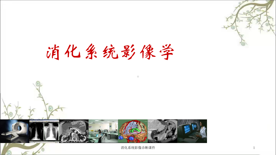 消化系统影像诊断课件.ppt_第1页