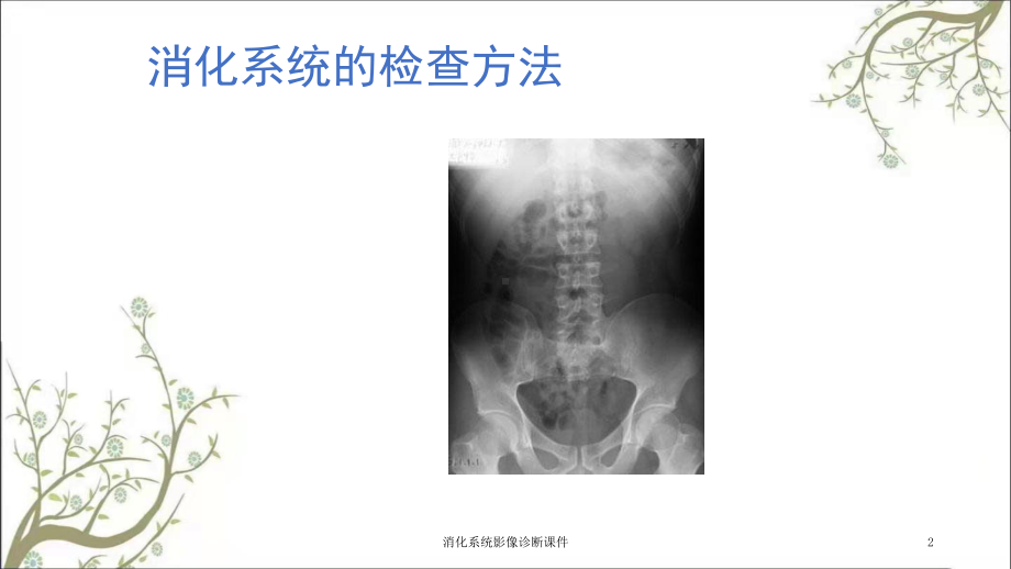 消化系统影像诊断课件.ppt_第2页