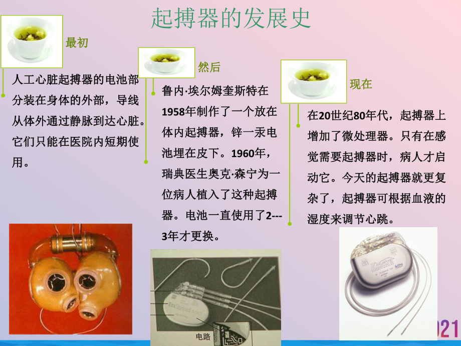 永久心脏起搏器的护理及心电图识别课件-2.ppt_第3页