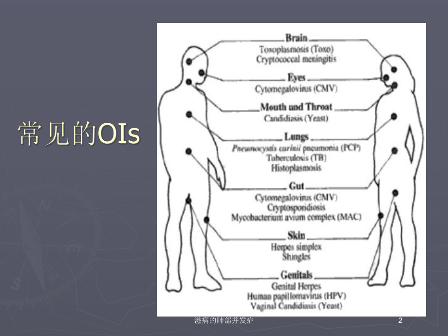 滋病的肺部并发症培训课件.ppt_第2页