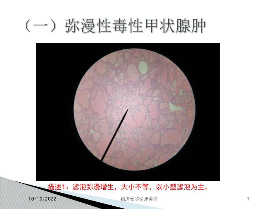 病理实验切片医学培训课件.ppt_第1页