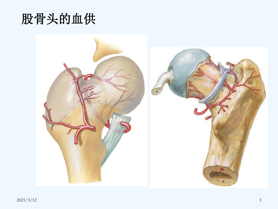 浅谈股骨颈骨折康复课件.ppt_第3页