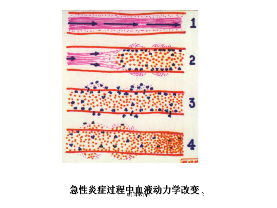 病理炎症课件.ppt_第2页