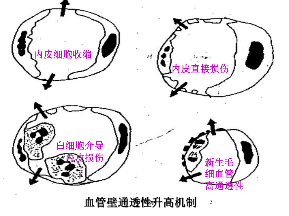 病理炎症课件.ppt_第3页