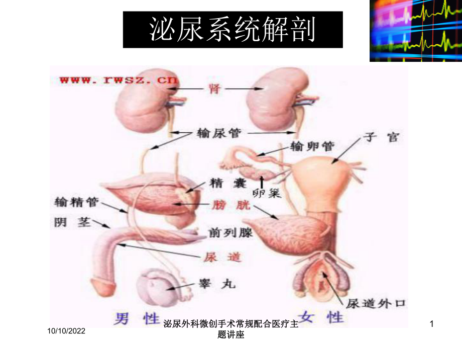 泌尿外科微创手术常规配合医疗主题讲座培训课件.ppt_第1页