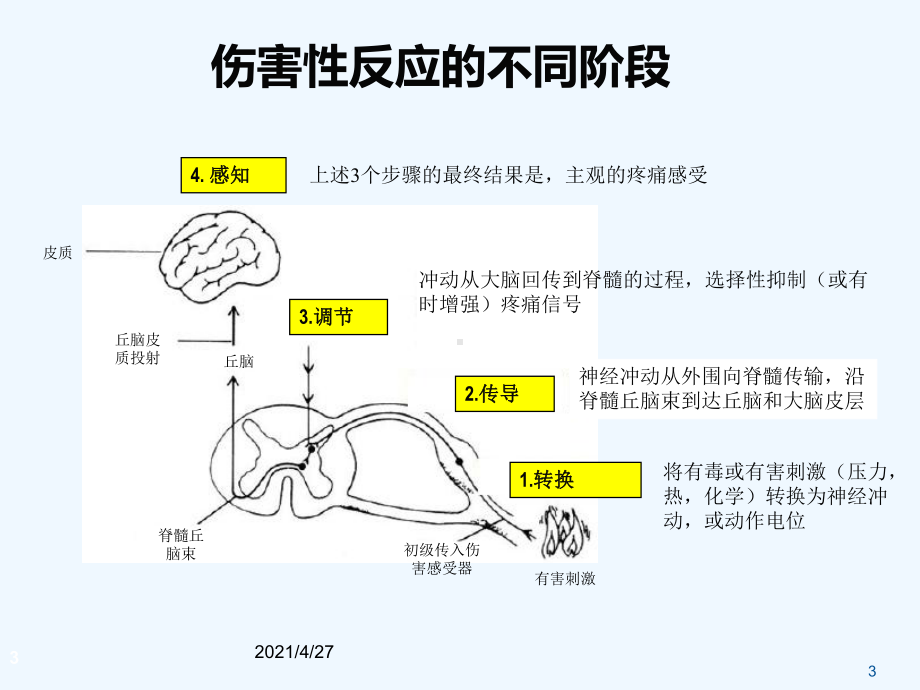 疼痛治疗必要性和疼痛治疗方案.ppt_第3页