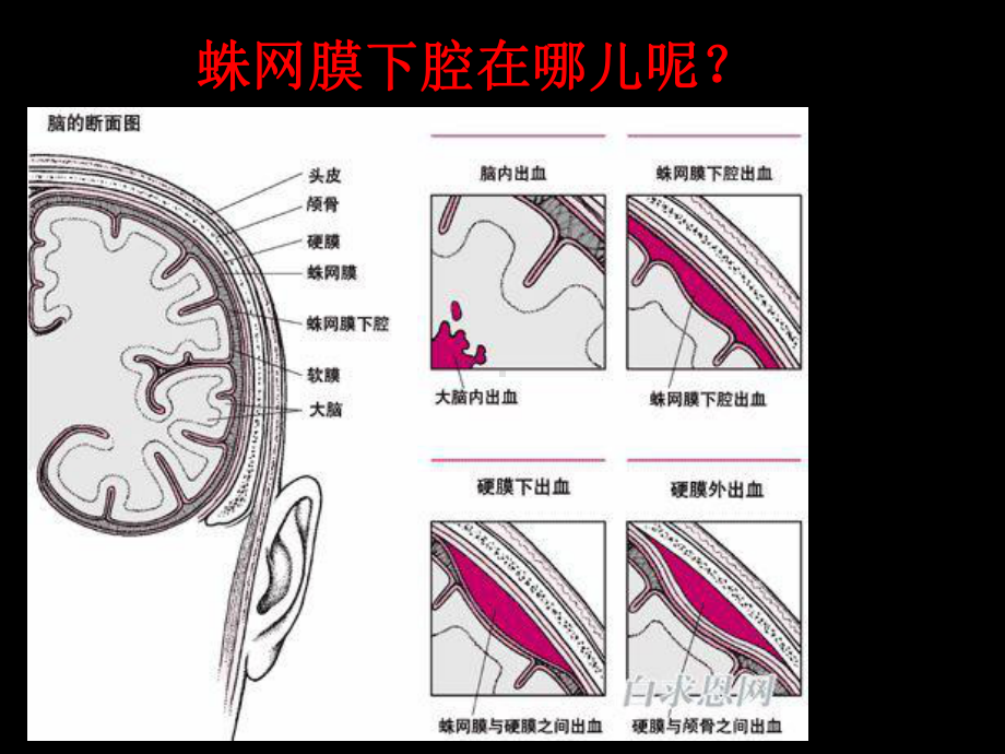 珠网膜下腔出血课件-2.ppt_第2页