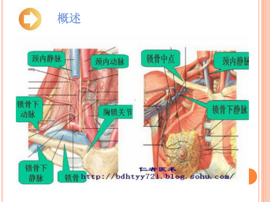 深静脉置管医疗护理培训课件-2.ppt_第3页