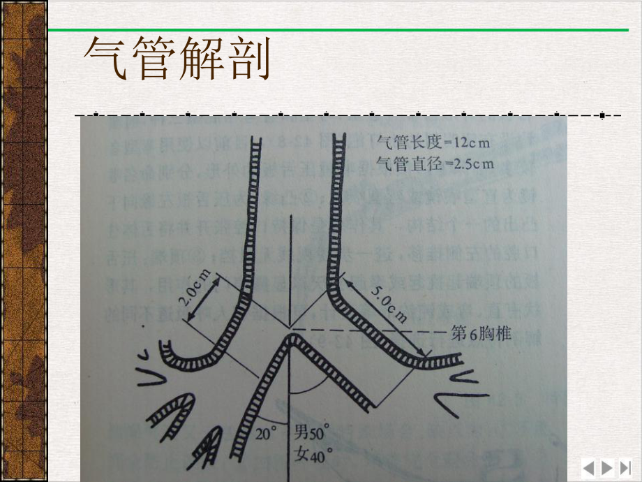 气管内插管术及深静脉置管完整版课件.pptx_第2页