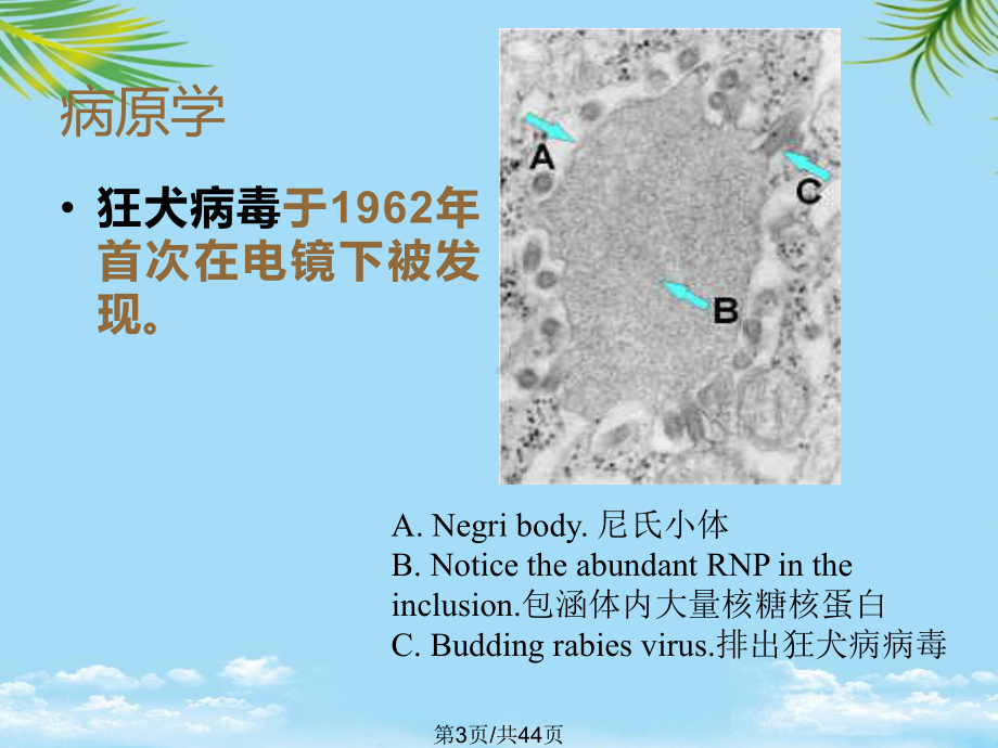 狂犬病全面版课件.pptx_第3页