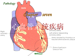 病理学心血管系统疾病课件.ppt