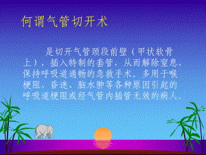 气管切开护理[1]课件.pptx