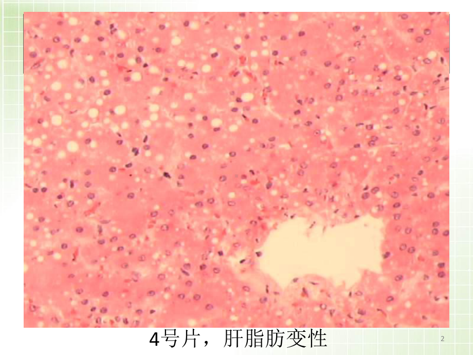 病理切片图优质课件.ppt_第2页