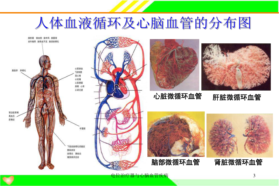 电位治疗器与心脑血管疾病课件.ppt_第3页