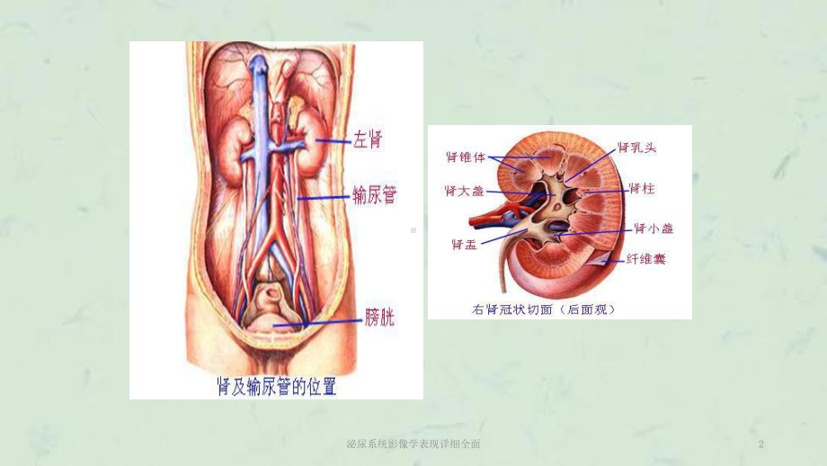 泌尿系统影像学表现详细全面课件.ppt_第2页