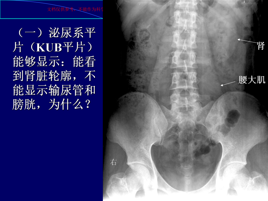 泌尿系统及肾上腺试验培训课件.ppt_第2页