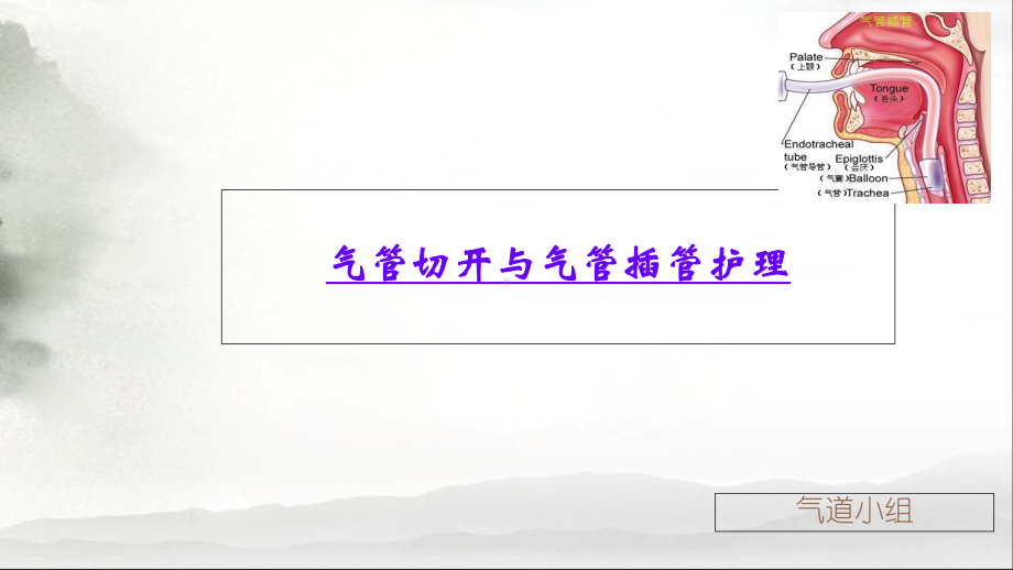 气管切开与气管插管护理教材课件.ppt_第1页