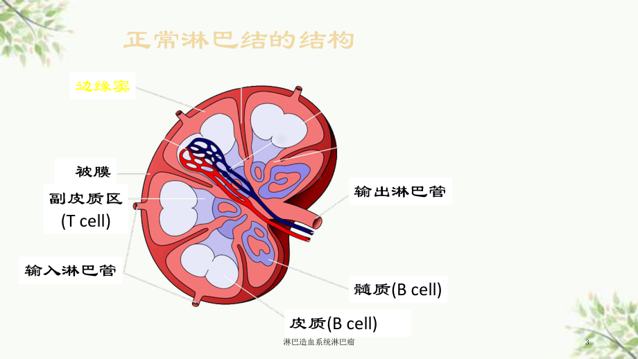 淋巴造血系统淋巴瘤课件.ppt_第3页