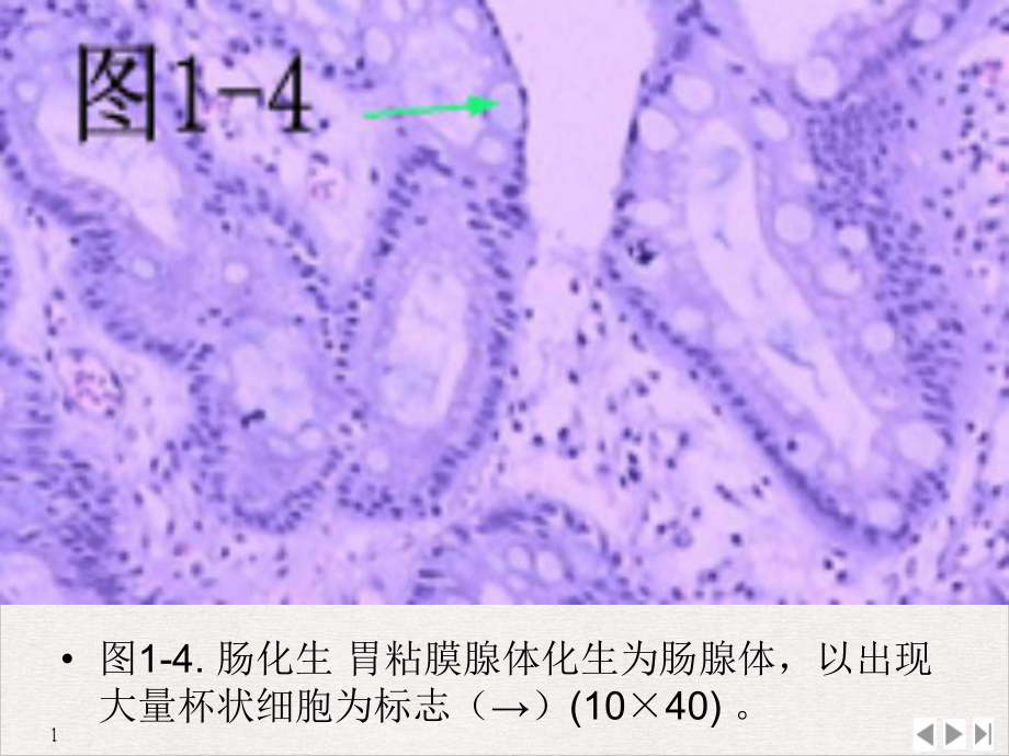 病理考试标本图片课件.pptx_第3页