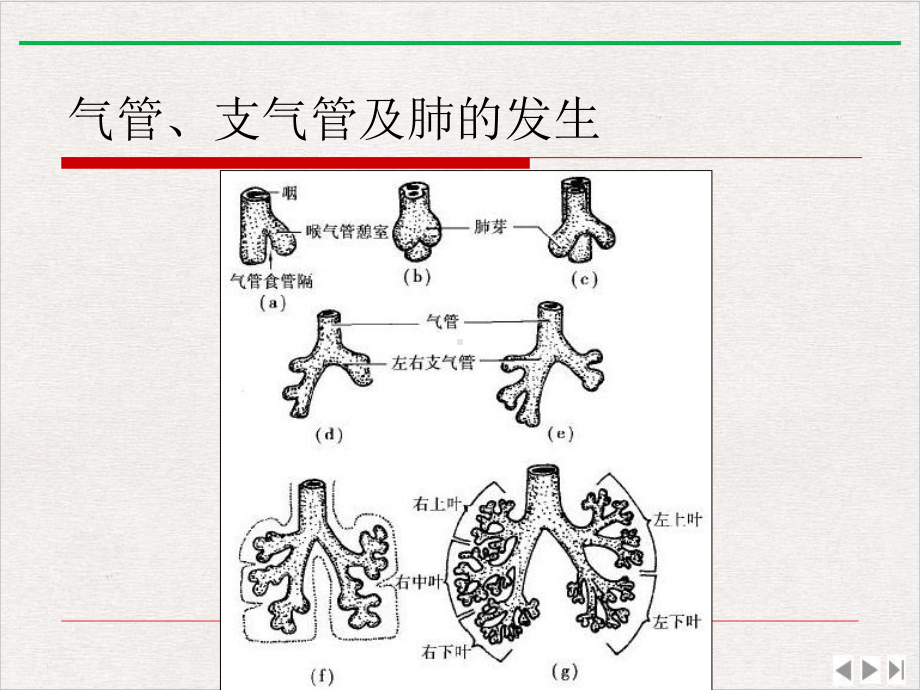 气管支气管及肺先天病变课件.pptx_第1页