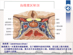 海绵窦区解剖参考课件.ppt