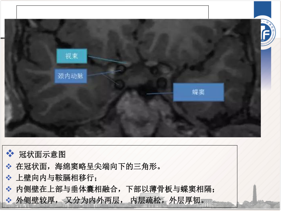 海绵窦区解剖参考课件.ppt_第2页