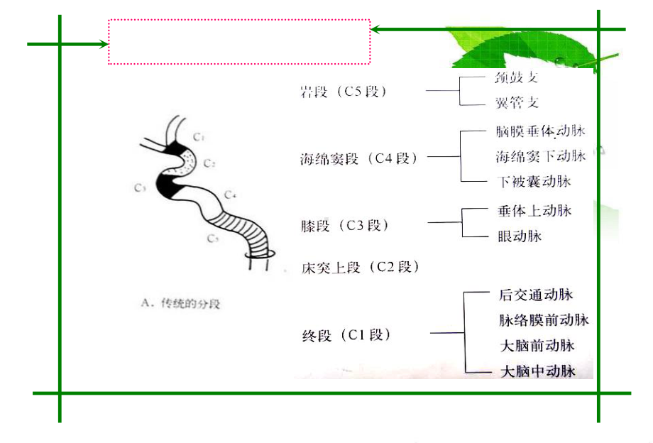 头颈部血管的CT MR诊断课件.ppt_第3页