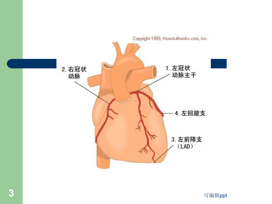 心绞痛的典型心电图表现课件.ppt_第3页