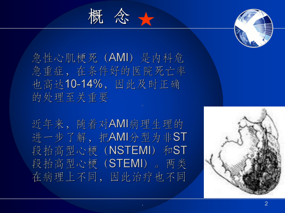 急性心肌梗死诊治课件.ppt_第2页