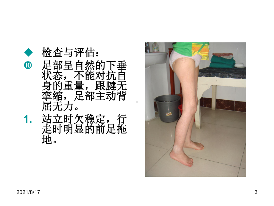 异常体征与矫形器应用课件.ppt_第3页