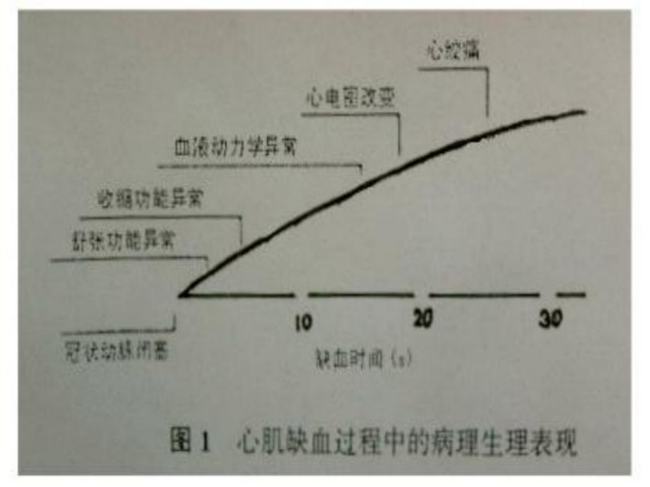 慢性冠状动脉供血不足心电图概念的质疑课件.ppt_第3页