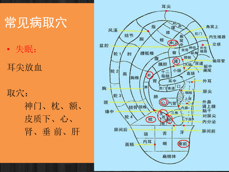 常见病的耳穴疗法课件.ppt_第3页