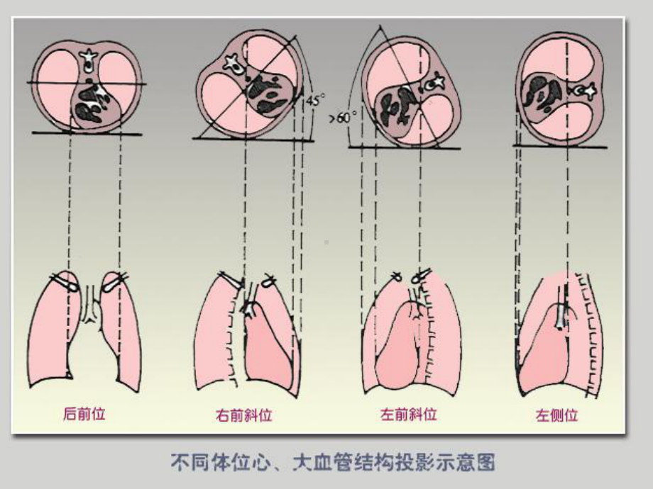 循环系统影像学表现(详细、全面)课件.ppt_第3页