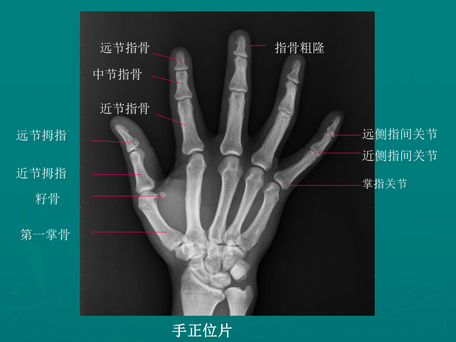 影像解剖课件.ppt_第3页