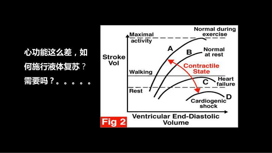 心源性休克的液体管理课件.pptx_第3页