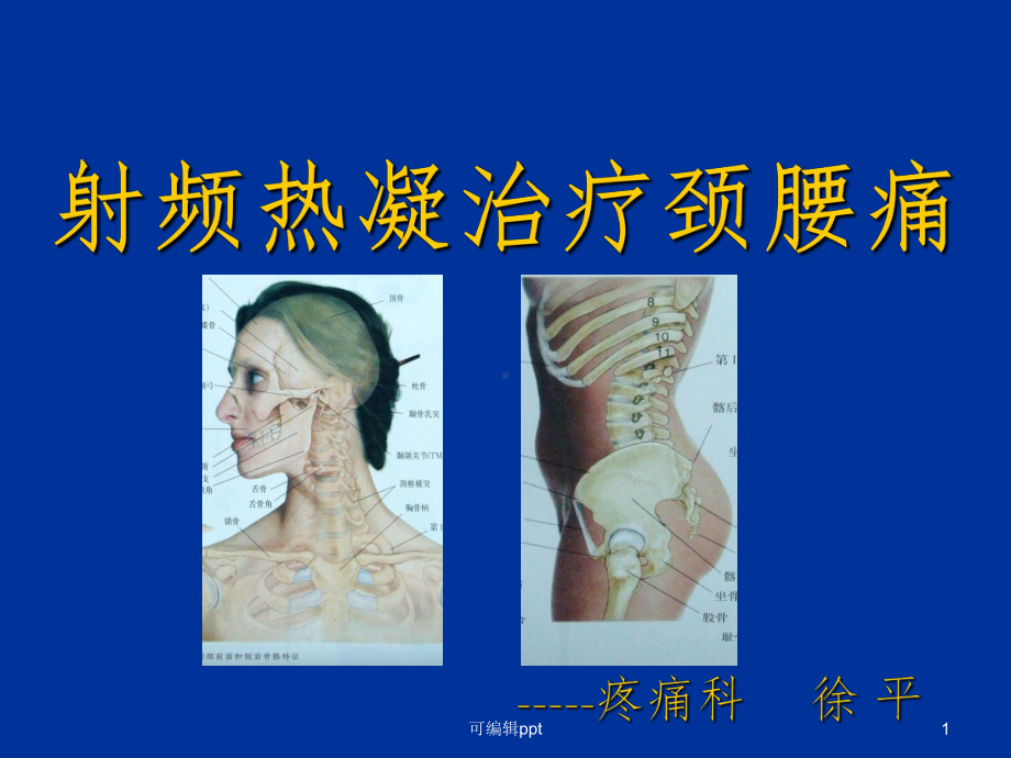 射频热凝治疗颈腰痛课件.ppt_第1页