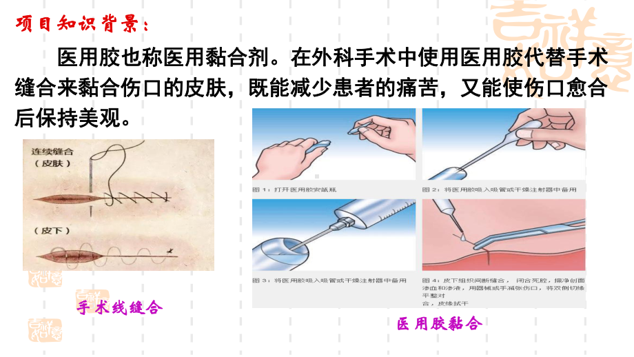 微项目探秘神奇的医用胶课件.pptx_第3页