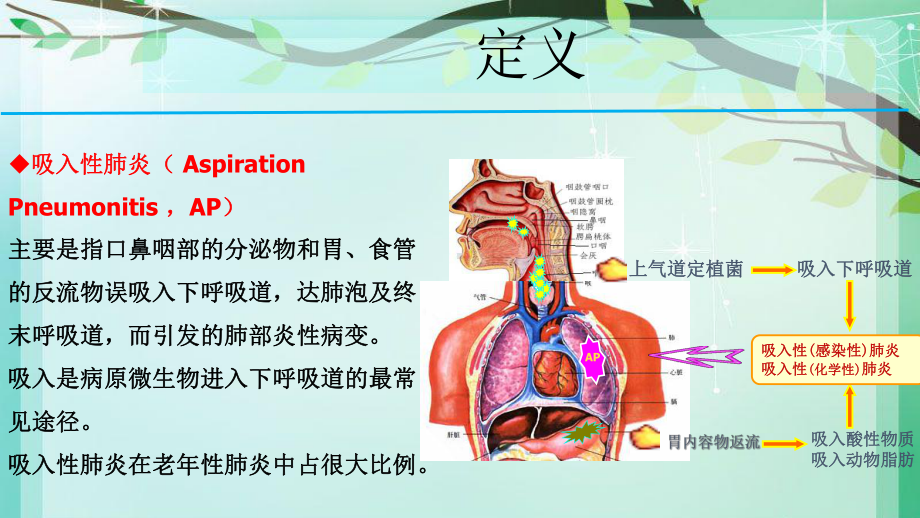 老吸入性肺炎的诊治与预防课件.ppt_第3页