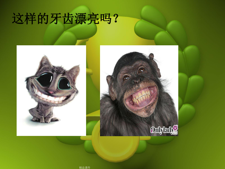 窝沟封闭讲座课件整理 .ppt_第2页