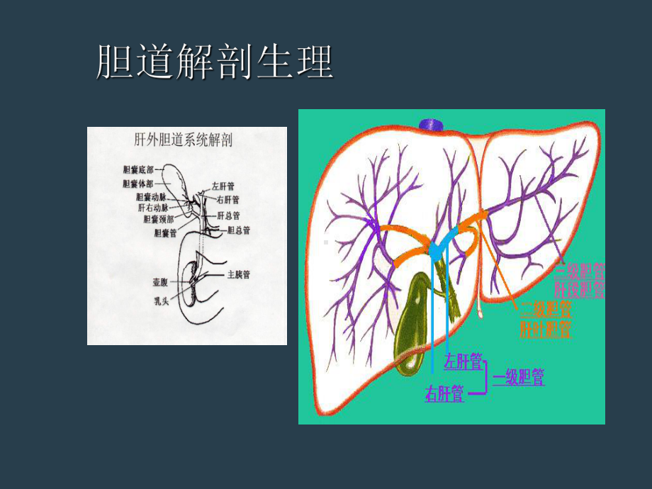 胆囊结石的诊治课件.ppt_第3页