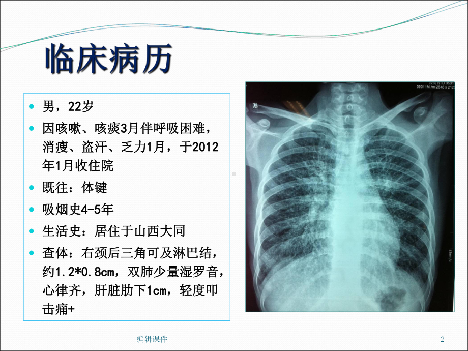 肺癌的预防和早期发现课件.ppt_第2页