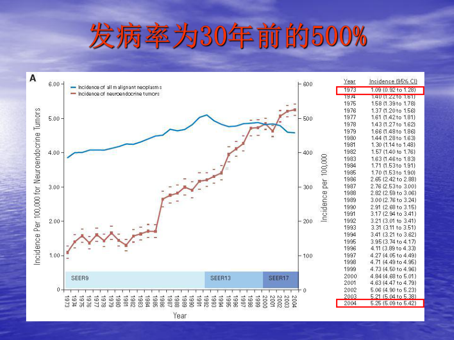 神经内分泌肿瘤讲稿课件.ppt_第3页