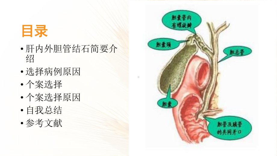 肝内外胆管结石 护理课件.ppt_第3页