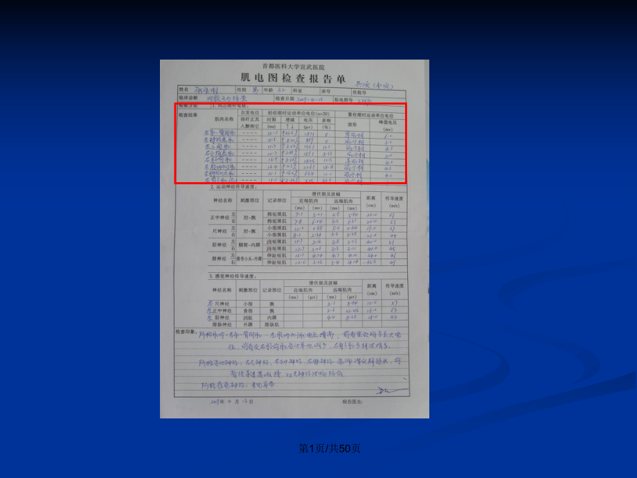 肌电图的判读教案课件.pptx_第2页