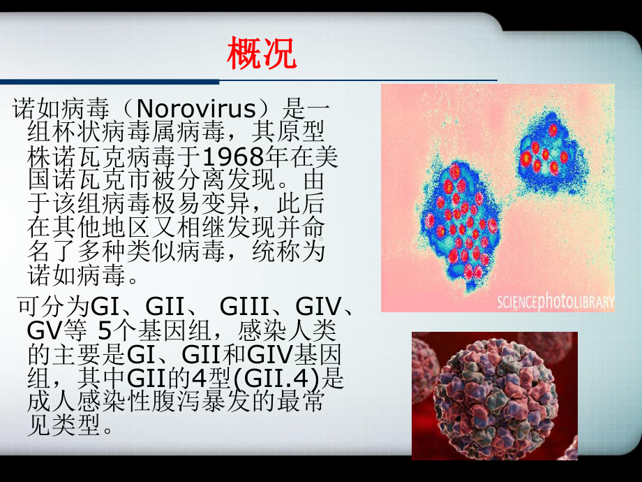 预防诺如病毒主题班会课件 .ppt_第3页