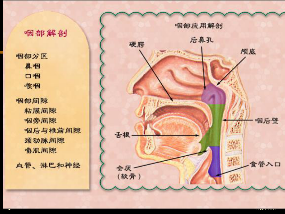 鼻咽癌的影像诊断课件.ppt_第3页