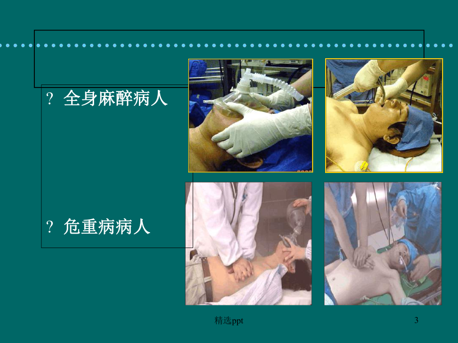 麻醉教学气道管理课件.ppt_第3页